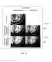 Fig. 07 - Motion correction in accelerated T1-weighted magnetic resonance imaging