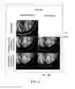 Fig. 08 - Motion correction in accelerated T1-weighted magnetic resonance imaging