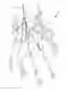 Fig. 01 - Subcutaneous vein pattern detection via multi-spectral IR imaging in an identity verification system