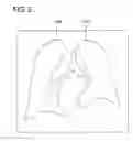 Fig. 03 - Medical image processing apparatus and medical image processing program