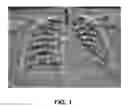 Fig. 02 - Enhanced visualization for medical images