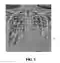 Fig. 07 - Enhanced visualization for medical images