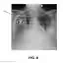 Fig. 09 - Enhanced visualization for medical images