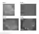 Fig. 09 - ADIPOSE-DERIVED INDUCED PLURIPOTENT STEM CELLS