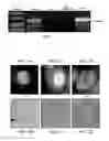 Fig. 02 - Composition and method for diagnosis and immunotherapy of prostate cancer