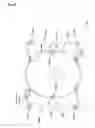 Fig. 09 - Device for balance exercises and balance games using variable restoring forces