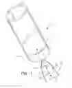 Fig. 02 - Surgical retractor extensions