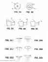 Fig. 02 - Device and method for intraocular drug delivery