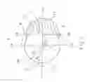 Fig. 03 - Apparatus for the constant-angle fixation and compression of a fracture or osteotomy of a bone