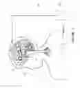 Fig. 02 - System and apparatus for early detection, prevention, containment or abatement of spread abnormal brain activity