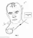 Fig. 02 - Implantable medical devices storing graphics processing data