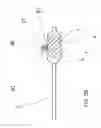 Fig. 08 - Adjustable bifurcation catheter incorporating electroactive polymer and methods of makings and using the same