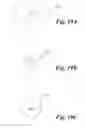 Fig. 20 - System for electromagnetic pulse surface treatment