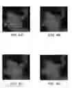 Fig. 07 - Amorphous and partially amorphous nanoscale ion storage materials