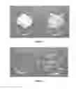 Fig. 02 - Medicinal Cream Made Using Hydrocortisone Acetate and A Process To Make The Same