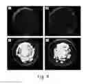 Fig. 09 - Method of inhibiting harmful microorganisms and barrier-forming composition therefor