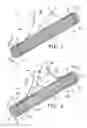 Fig. 02 - Emergency vascular repair system and method