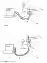 Fig. 02 - MOBILE RESPIRATOR