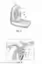 Fig. 03 - Belt Holding Tool