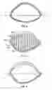 Fig. 03 - High-speed differential comparator circuitry with accurately adjustable threshold
