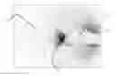 Fig. 01 - Apparatus for eliminating background noise