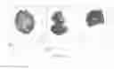 Fig. 07 - DRUG DELIVERY FROM EMBOLIC AGENTS
