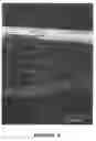 Fig. 04 - Bioresorbable and biocompatible compounds for surgical use