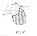Fig. 03 - Apparatus and method of forming barbs on a suture