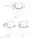 Fig. 22 - Apparatus for making a micro-textured web