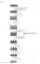 Fig. 02 - Patterning process