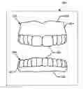 Fig. 01 - DESIGN AND MANUFACTURE OF DENTURES