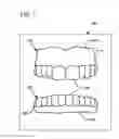 Fig. 02 - DESIGN AND MANUFACTURE OF DENTURES