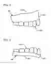 Fig. 03 - DESIGN AND MANUFACTURE OF DENTURES