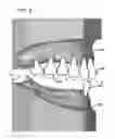 Fig. 06 - DESIGN AND MANUFACTURE OF DENTURES