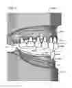 Fig. 07 - DESIGN AND MANUFACTURE OF DENTURES