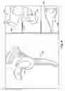 Fig. 08 - SYSTEM OF PREOPERATIVE PLANNING AND PROVISION OF PATIENT-SPECIFIC SURGICAL AIDS
