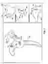 Fig. 09 - SYSTEM OF PREOPERATIVE PLANNING AND PROVISION OF PATIENT-SPECIFIC SURGICAL AIDS