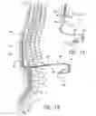 Fig. 02 - Operating room lead connector