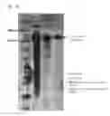 Fig. 07 - Modified human tumor necrosis factor receptor-1 polypeptide or fragment thereof, and method for preparing same