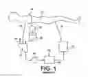 Fig. 02 - Combination oxygenator and arterial filter device with a fiber bundle of continuously wound hollow fibers for treating blood in an extracorporeal blood circuit