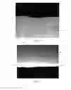 Fig. 09 - Absorbent Members Having Skewed Density Profile