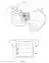 Fig. 03 - Use of micro- and miniature position sensing devices for use in TKA and THA