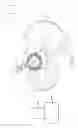 Fig. 06 - Use of micro- and miniature position sensing devices for use in TKA and THA