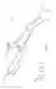 Fig. 08 - Use of micro- and miniature position sensing devices for use in TKA and THA