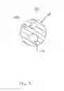 Fig. 03 - System and method for percutaneous mitral valve repair