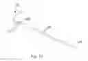 Fig. 06 - System and method for percutaneous mitral valve repair