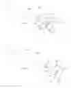Fig. 48 - System and method for percutaneous mitral valve repair
