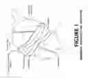 Fig. 02 - Absorbent heat-directing apparatus