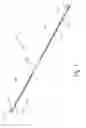 Fig. 02 - Electrical stimulation lead with stiffeners having varying stiffness zones