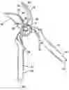 Fig. 01 - Multiple cut zone blade assembly for a hand operated cutting tool